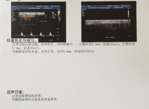 醫(yī)用B超膠片的作用