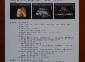 醫(yī)用噴墨膠片有哪些特點